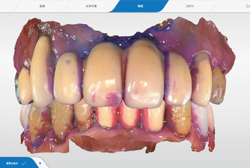 [写真] 初診から6年後