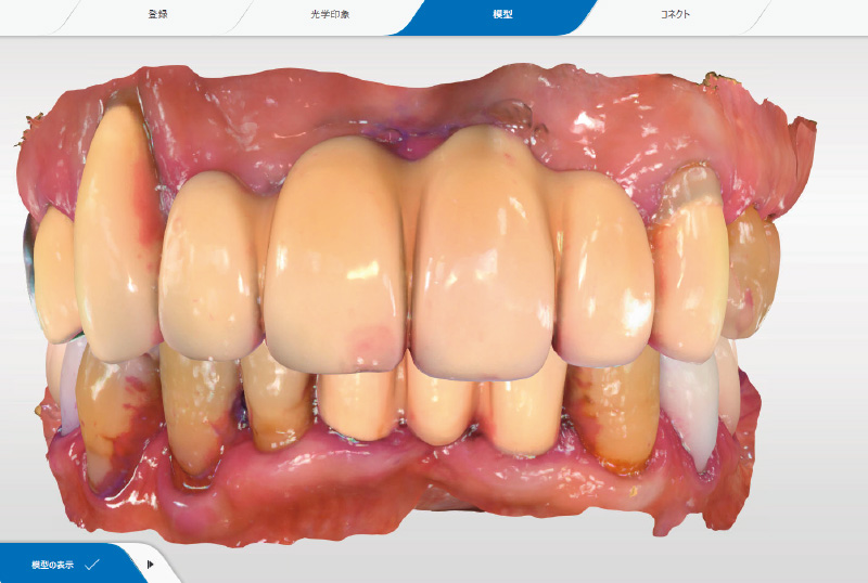 [写真] 図4から3か月経過後の状態