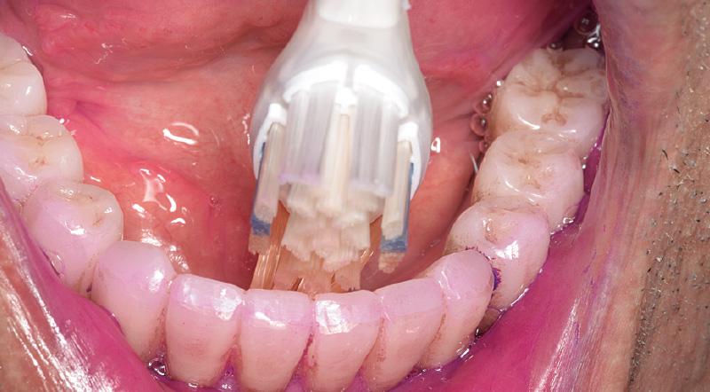 [写真] 「ソニッケアー6100」を初めて使用