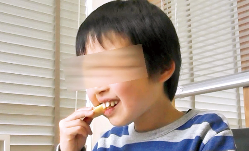 [写真] りんごを噛み切る時も前歯を使わず側方歯を使う