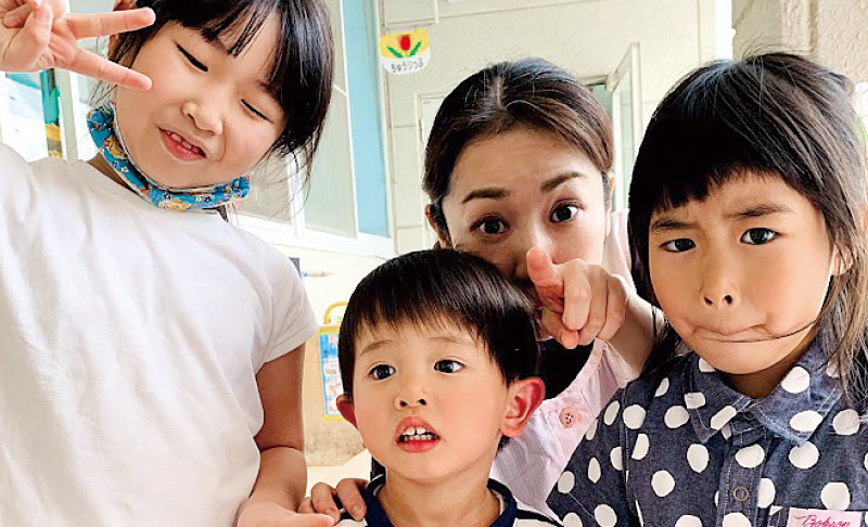 [写真] 常時口呼吸の5歳児