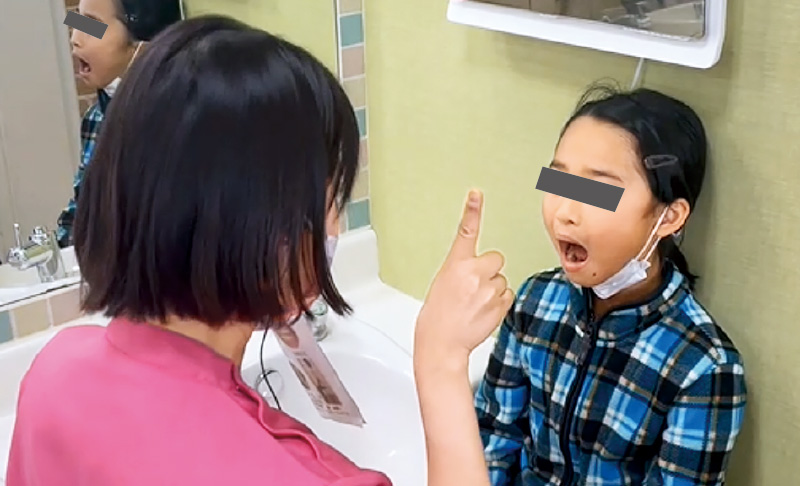 [写真] 口腔筋機能訓練の様子