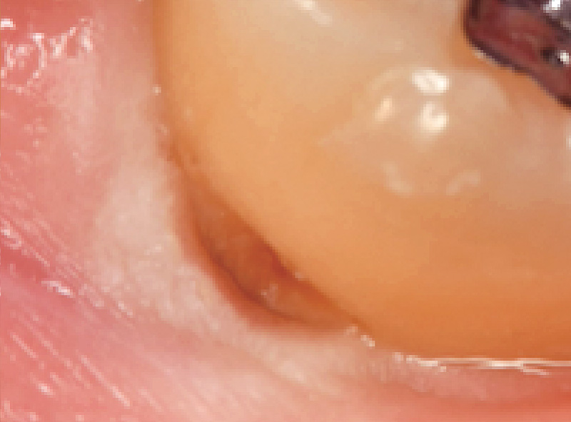 [写真] 術野を拡大