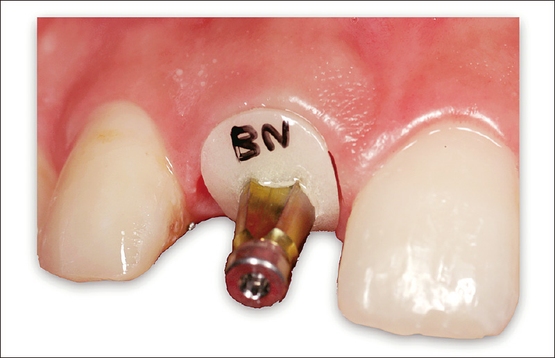 [写真] アナログ印象