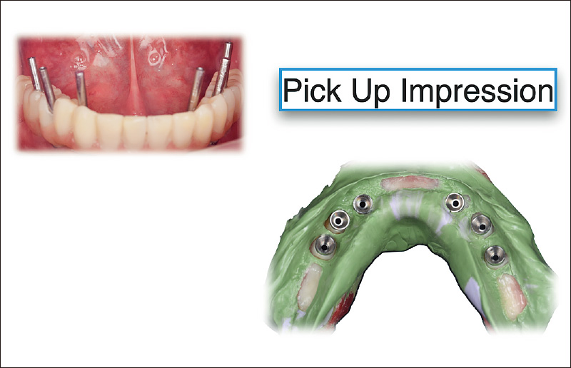 [写真] Pick Up印象