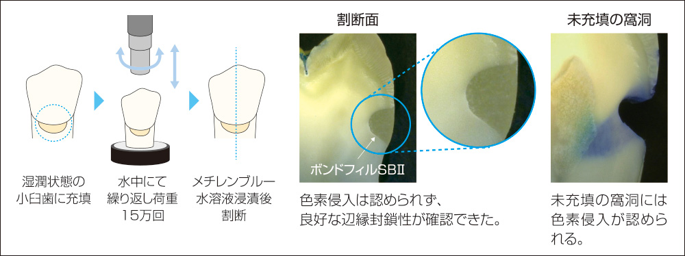 [写真] 色素侵入試験