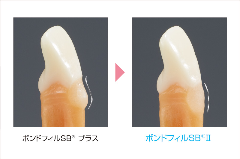 [写真] ボンドフィルSBⓇプラスとボンドフィルSBⓇⅡの比較