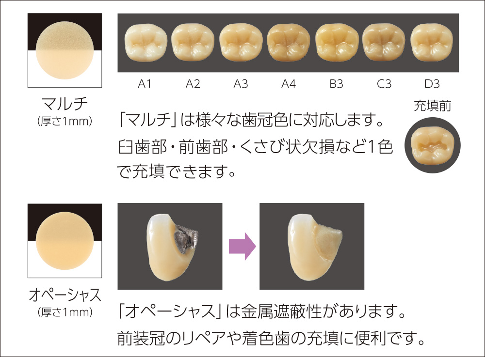 [写真] 様々な歯冠色に対応する「マルチ」と遮蔽性のある「オペーシャス」