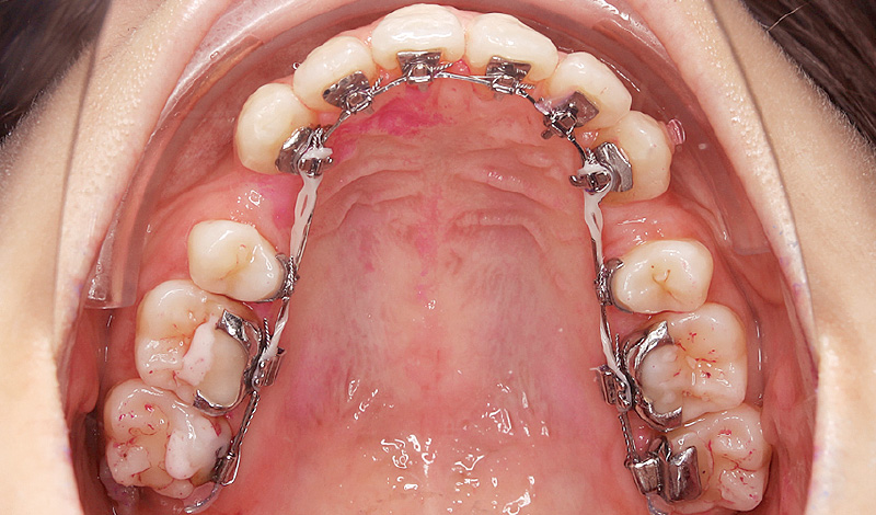 [写真] セルフケア後の状態