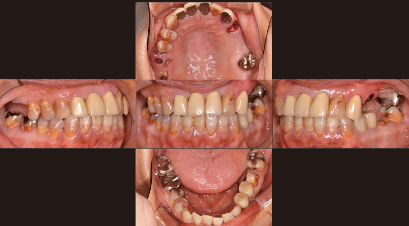 [写真] 初診時 60代女性