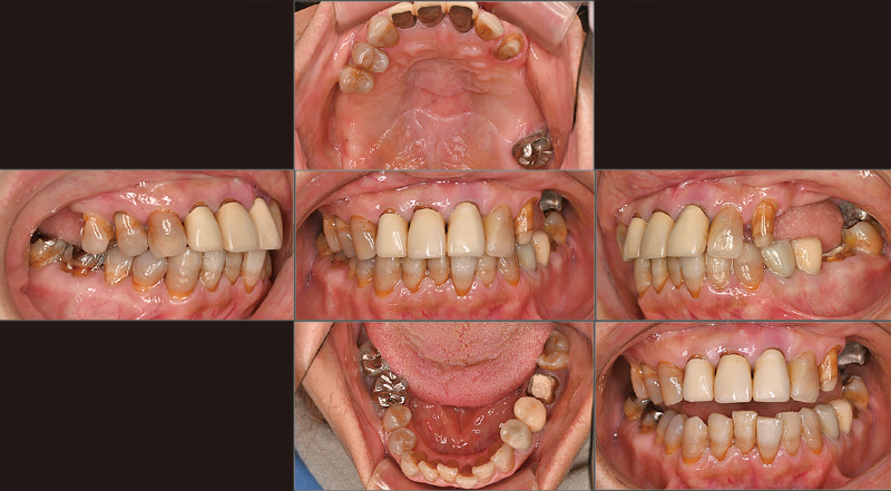 [写真] 2024年2月再診時