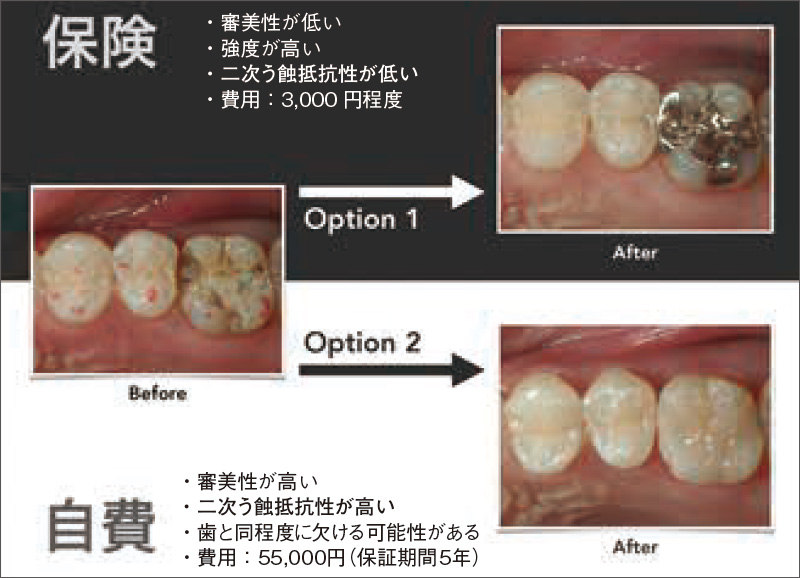 [写真] 自費診療と保険診療の特徴について、患者さんに説明するためのツール