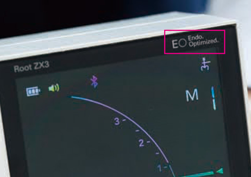 [写真] 「ルートZX3」のパネル上部に付与された「EO」のロゴマーク