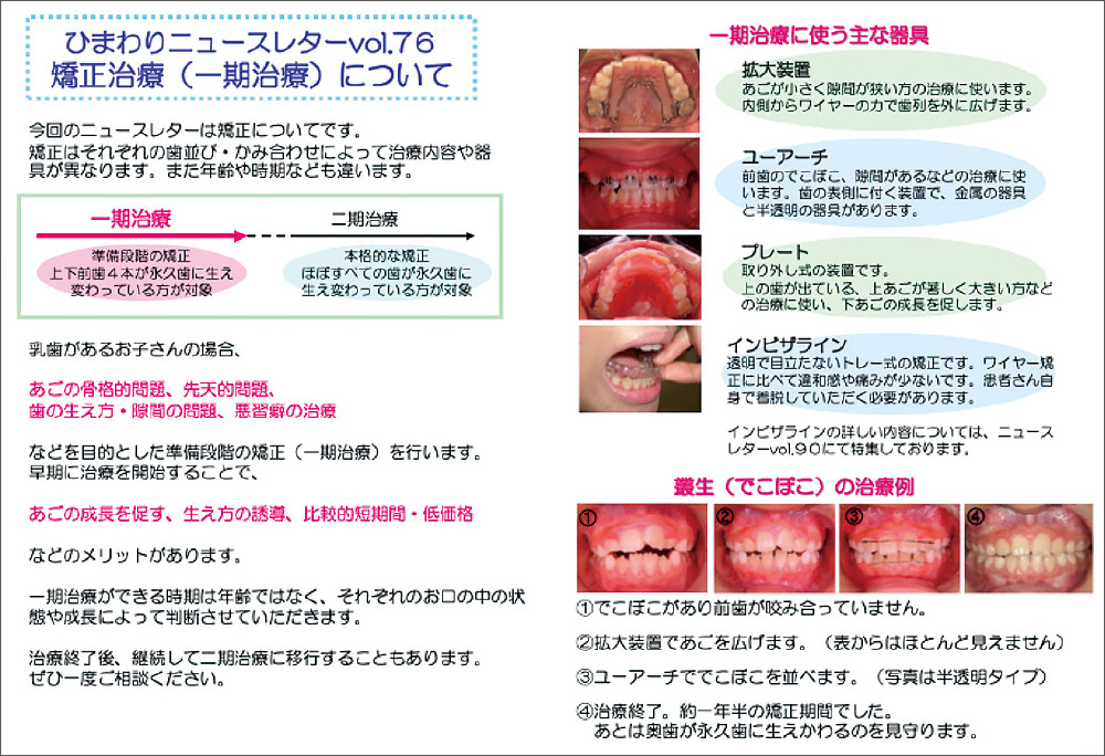 [写真] 説明用ニュースレター