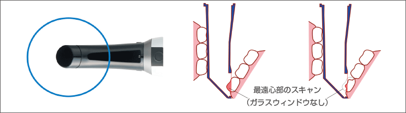 [図] スキャンチップの説明