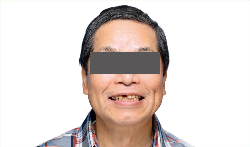 [写真] 初診時顔貌写真