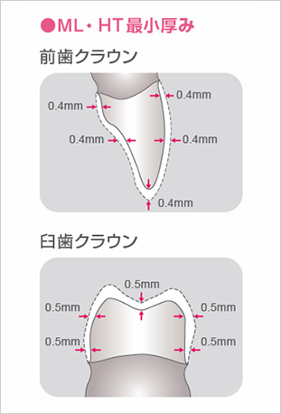 ML・HT最小厚み