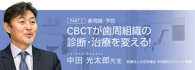 PART 2 歯周病・予防　CBCTが歯周組織の診断・治療を変える！中田 光太郎先生 医療法人社団洛歯会 中田歯科クリニック 院長