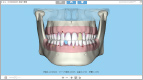 Perio3D Viewの画面