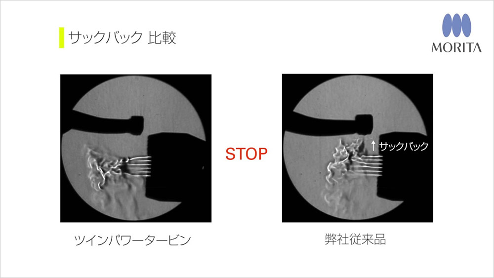 動画のサムネイル