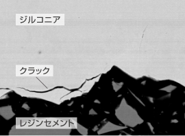 過度な圧力でサンドブラスト処理したジルコニア接着界面