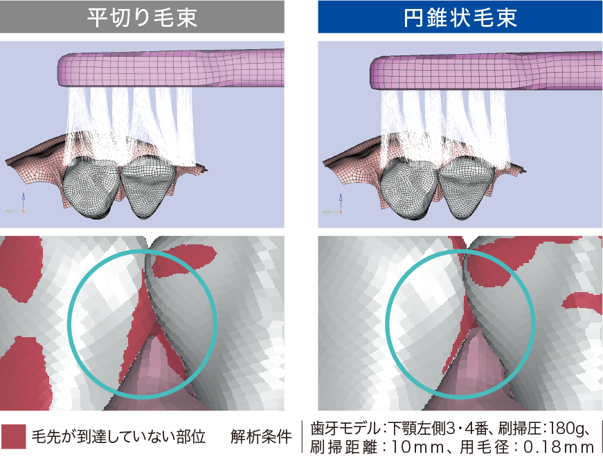 歯牙モデルにおける毛先の到達性の有限要素法（FEM）解析