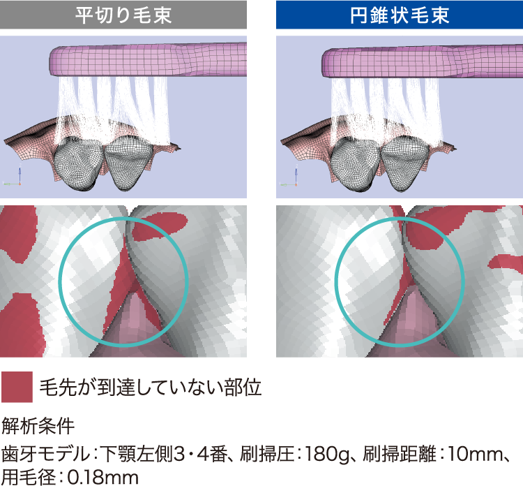 歯牙モデルにおける毛先の到達性の有限要素法（FEM）解析