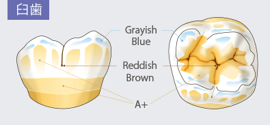 臼歯　Grayish Blue　Reddish Brown　A+