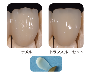 エナメル　トランスルーセント