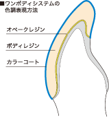 ワンボディシステムの色調表現方法