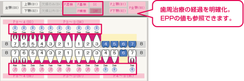 歯周治療の経過を明確化。EPPの値も参照できます。