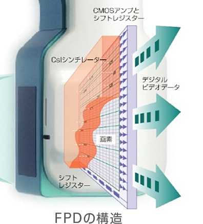 [図] FPDの構造