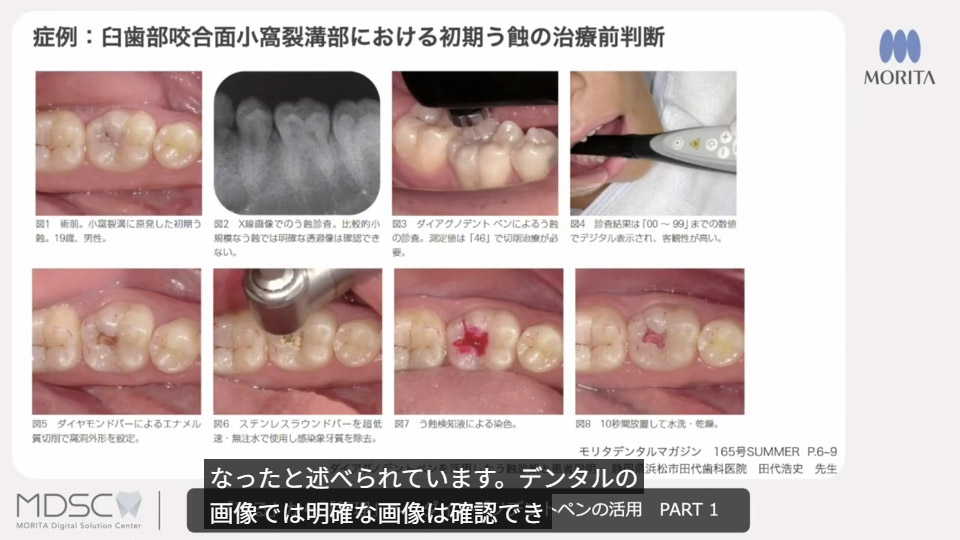 活用方法を知る動画のサムネイル