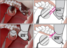 トルクテックと従来品 比較