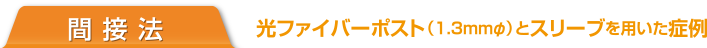 間接法 光ファイバーポスト（1.3mmΦ）とスリーブを用いた症例