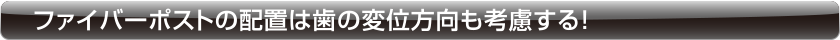 ファイバーポストの配置は歯の変位方向も考慮する！