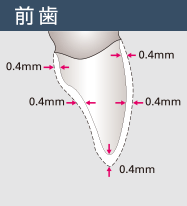 前歯