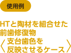 [使用例]HTと陶材を組合せた前歯修復物＜支台歯色を反映させるケース＞