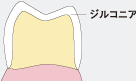 フルジルコニア（FZ）クラウンのイメージ