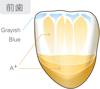 グレーズ & ステイン例　前歯のイメージ