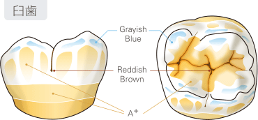 グレーズ & ステイン例　臼歯のイメージ