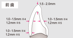 推奨形成例（前歯）