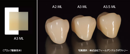 マルチレイヤード構造によるグラデーションの写真