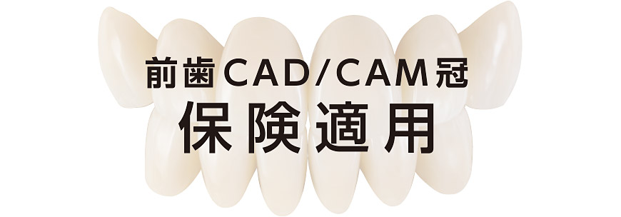 保険適用 前歯CAD/CAM冠