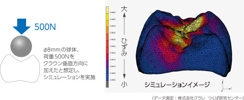 臼歯部咬合負荷シミュレーションのイメージ