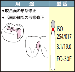 FO-30F