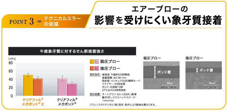 テクニカルエラーの低減 エアーブローの影響を受けにくい象牙質接着