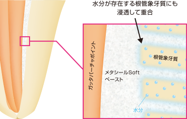 水分が存在する根管象牙質にも浸透して重合