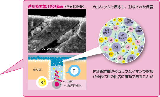 適用後の象牙室割断面