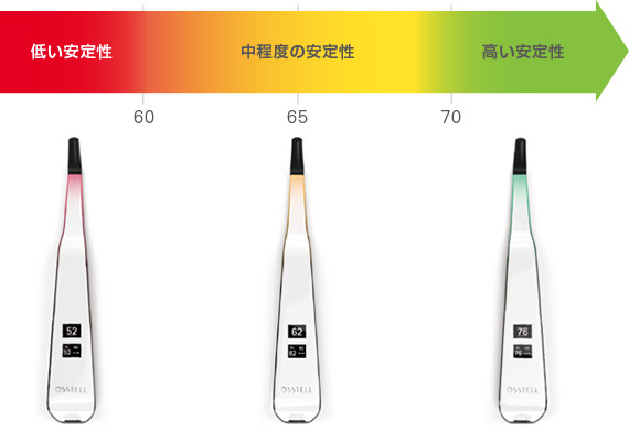 ISQ値とインプラント体安定性の目安